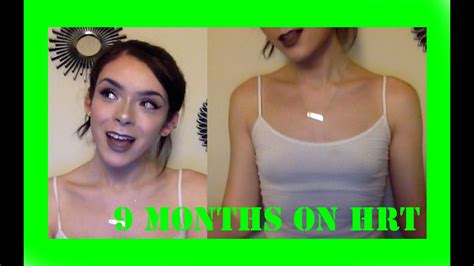 teen small tits|Normal Breast Development and Changes